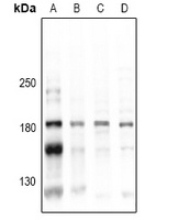 CD45 (Phospho-Y1216) Rabbit Polyclonal Antibody