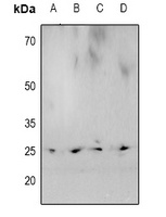 HP1 alpha (Phospho-S92) Rabbit Polyclonal Antibody