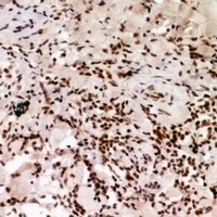 HP1 alpha (Phospho-S92) Rabbit Polyclonal Antibody