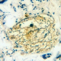 nNOS (Phospho-S1417) Rabbit Polyclonal Antibody