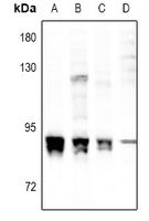 PKC alpha (Phospho-S657) Rabbit Polyclonal Antibody