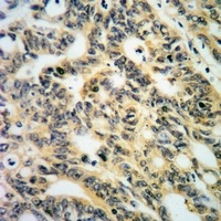PKC alpha (Phospho-S657) Rabbit Polyclonal Antibody