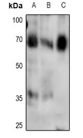 SMAD4 (Phospho-T276) Rabbit Polyclonal Antibody