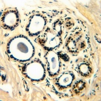 SMAD4 (Phospho-T276) Rabbit Polyclonal Antibody