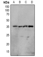 OTUB1 (Phospho-S187) Rabbit Polyclonal Antibody