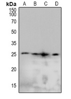 Caveolin 2 (Phospho-Y19) Rabbit Polyclonal Antibody
