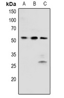 BRK (Phospho-Y342) Rabbit Polyclonal Antibody