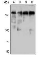 DAP Kinase 1 (Phospho-S736) Rabbit Polyclonal Antibody