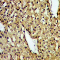 DAP Kinase 1 (Phospho-S736) Rabbit Polyclonal Antibody