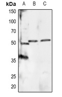 RXR alpha (Phospho-S260) Rabbit Polyclonal Antibody