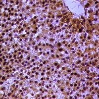 RXR alpha (Phospho-S260) Rabbit Polyclonal Antibody