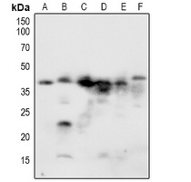 NACA1 (Phospho-S43) Rabbit Polyclonal Antibody