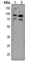 TORC2 (Phospho-S171) Rabbit Polyclonal Antibody