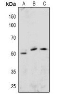 ETS1 (Phospho-S251) Rabbit Polyclonal Antibody