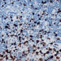 ETS1 (Phospho-S251) Rabbit Polyclonal Antibody