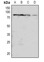 PKC beta (Phospho-T641) Rabbit Polyclonal Antibody