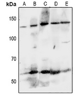 EPHA8 Rabbit Polyclonal Antibody
