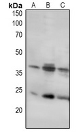 LAT Rabbit Polyclonal Antibody