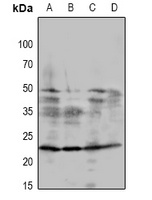 DSCR1 Rabbit Polyclonal Antibody