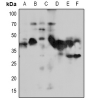 NACA1 Rabbit Polyclonal Antibody