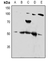 PTP1B Rabbit Polyclonal Antibody