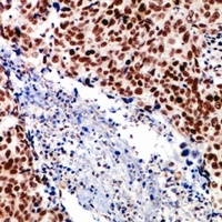 SRF Rabbit Polyclonal Antibody