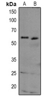 TAB1 Rabbit Polyclonal Antibody