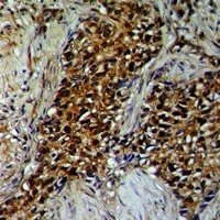 TAB1 Rabbit Polyclonal Antibody