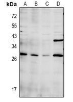 CDC42EP3 Rabbit Polyclonal Antibody