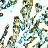 CDC42EP3 Rabbit Polyclonal Antibody