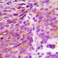 ATG4A Rabbit Polyclonal Antibody