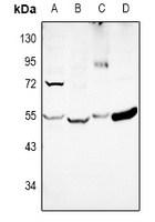 DKK3 Antibody