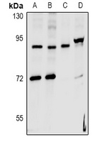hnRNP UL2 Rabbit Polyclonal Antibody