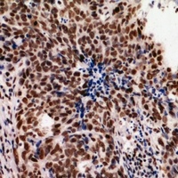 hnRNP UL2 Rabbit Polyclonal Antibody