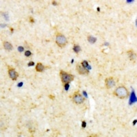 OXR1 Rabbit Polyclonal Antibody