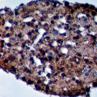 MYPT3 Rabbit Polyclonal Antibody