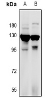 RANBP17 Antibody