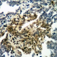RANBP17 Antibody