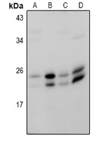 RAB18 Rabbit Polyclonal Antibody