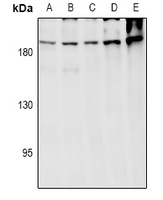 ARHGEF12 Rabbit Polyclonal Antibody
