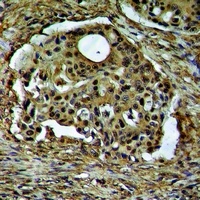 ARHGEF12 Rabbit Polyclonal Antibody