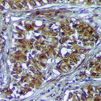 PLK3 Antibody