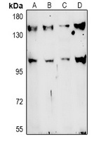 TAF3 Rabbit Polyclonal Antibody