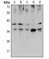ZIP1 Rabbit Polyclonal Antibody
