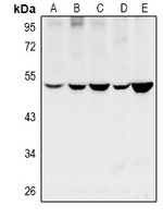 Cytochrome P450 11B1/2 Rabbit Polyclonal Antibody