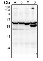 KLF12 Rabbit Polyclonal Antibody