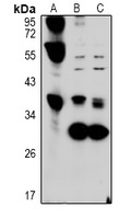 Hepassocin Rabbit Polyclonal Antibody
