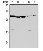 Caspase 8 (Cleaved-D384) Rabbit Polyclonal Antibody