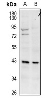 GPR173 Rabbit Polyclonal Antibody
