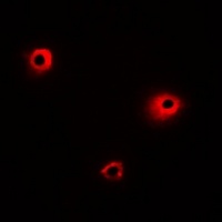 MRGX1 Rabbit Polyclonal Antibody